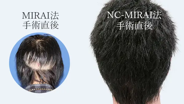 ヘアスタイルそのままでカバーシート不要
